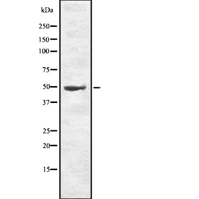 Polyclonal Rabbit anti-Human TMEM142A / ORAI1 Antibody (IHC, WB)