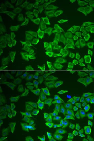 IHC-plus™ Polyclonal Rabbit anti-Human CRHBP Antibody (IHC, IF, WB)