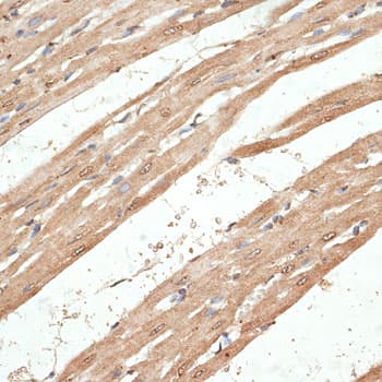 KLHDC3 Antibody