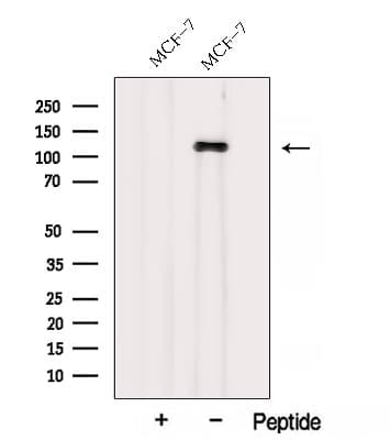 AFAP1 / AFAP Antibody