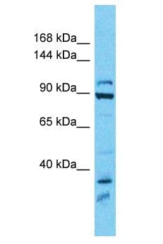 HIP1 Antibody (aa338-387)