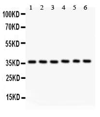 HMOX2 / Heme Oxygenase 2 Antibody (aa2-316)