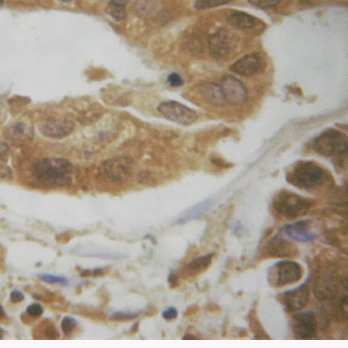 AKT1 Antibody (phospho-Ser124)