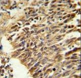 HIF1A / HIF1 Alpha Antibody (aa519-547)
