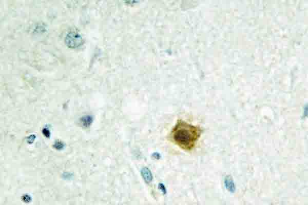 TAF15 Antibody (Asn380)