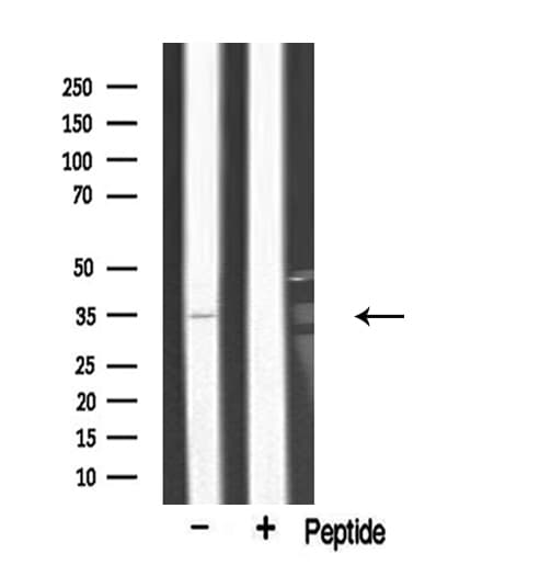 ARG1 / Arginase 1 Antibody
