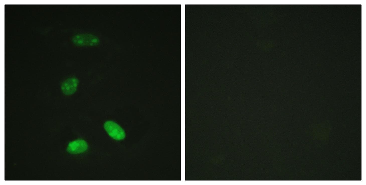 Polyclonal Rabbit anti-Human MYB / c-Myb Antibody (p12, IHC, IF, WB)