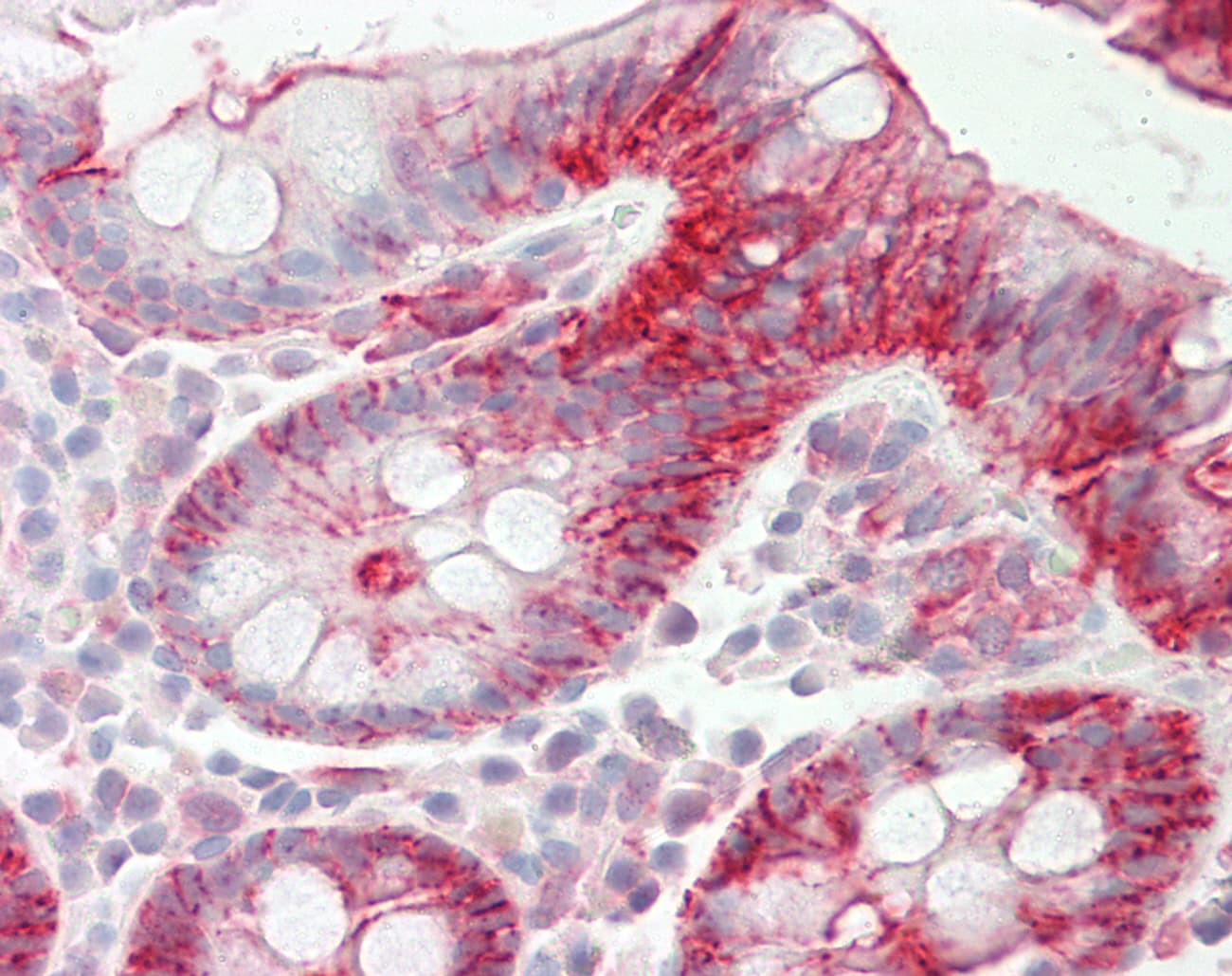 Polyclonal Rabbit anti-Human EPLIN Antibody (C-Terminus, IHC, WB)