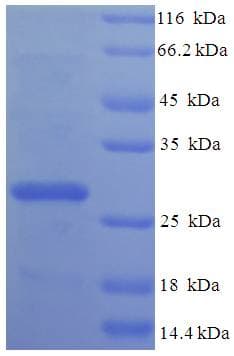 Human MRPL20 Protein (Recombinant His-SUMO)