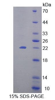 Mouse EEF1E1 / AIMP3 Protein (Recombinant His-T7, N-terminus)