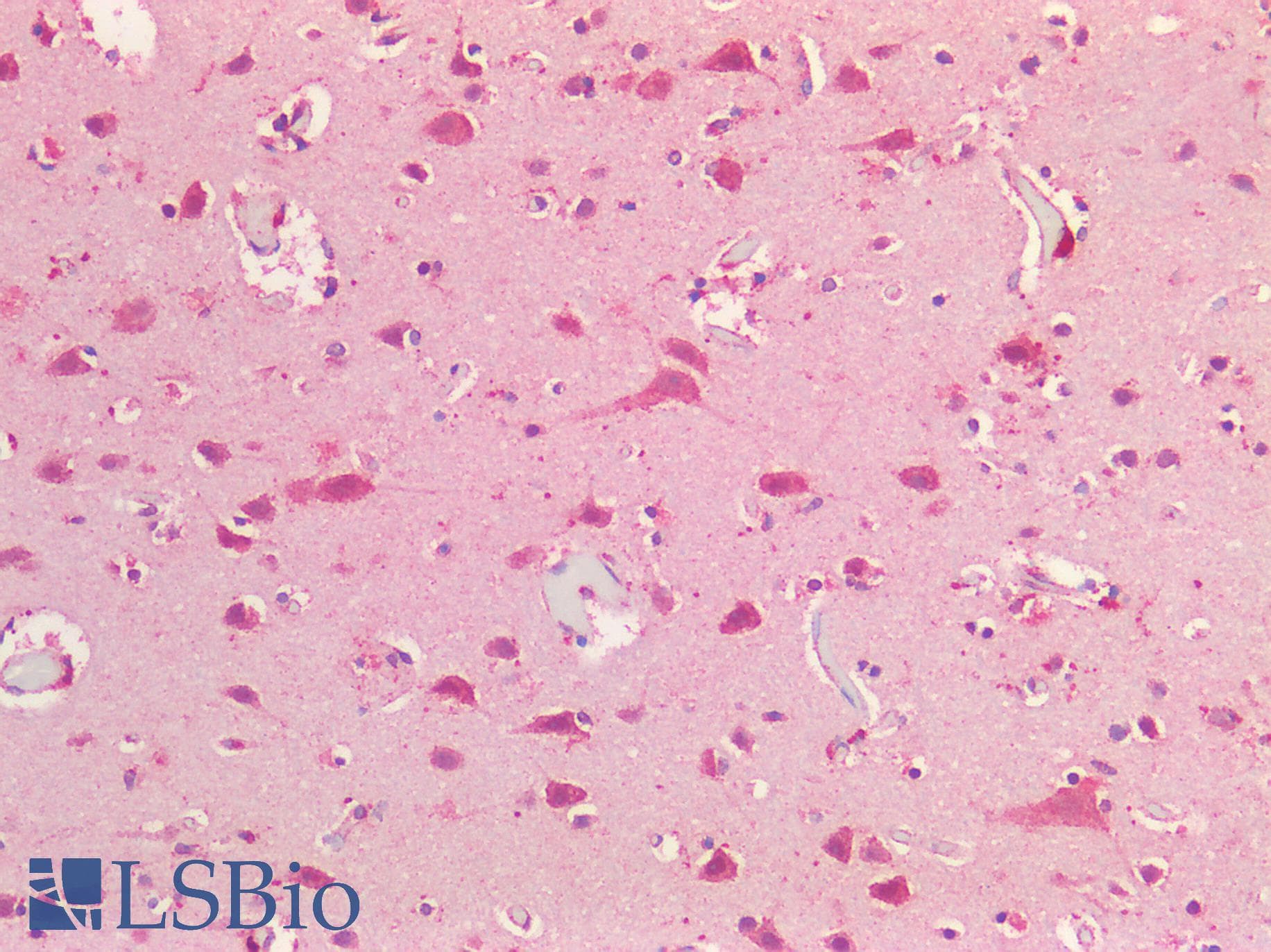 IHC-plus™ FOLH1 / PSMA Antibody