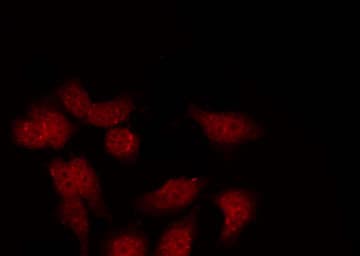 GSK3B / GSK3 Beta Antibody (phospho-Ser9)