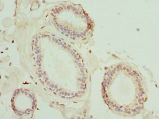 MATK Antibody