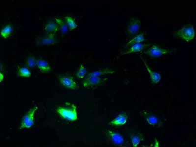 IHC-plus™ SLC25A25 Antibody