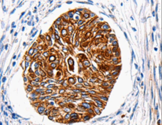 Polyclonal Rabbit anti-Human HTR1A / 5-HT1A Receptor Antibody (IHC, WB)