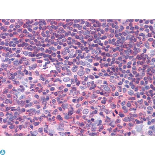 Monoclonal Mouse anti-Human PTK2B / PYK2 Antibody (IHC, WB)