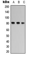Polyclonal Rabbit anti-Human MAPT / Tau Antibody (C-Terminus, IHC, IF, WB)