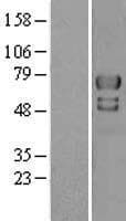 PIAS4 / PIASY Protein (Over-Expression Lysate Myc-DDK (Flag))