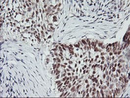 MYBPH Antibody (clone OTI3G1)