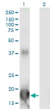 Monoclonal Mouse anti-Human ID4 Antibody (clone 3F11, WB)