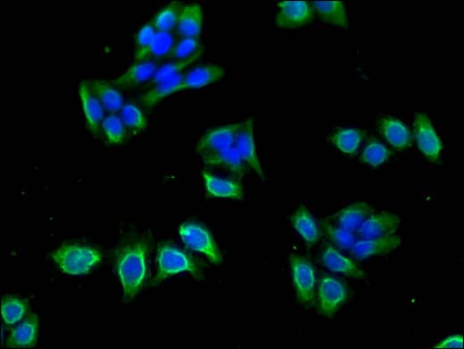 CACNB4 Antibody