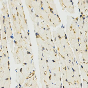 MYSM1 Antibody