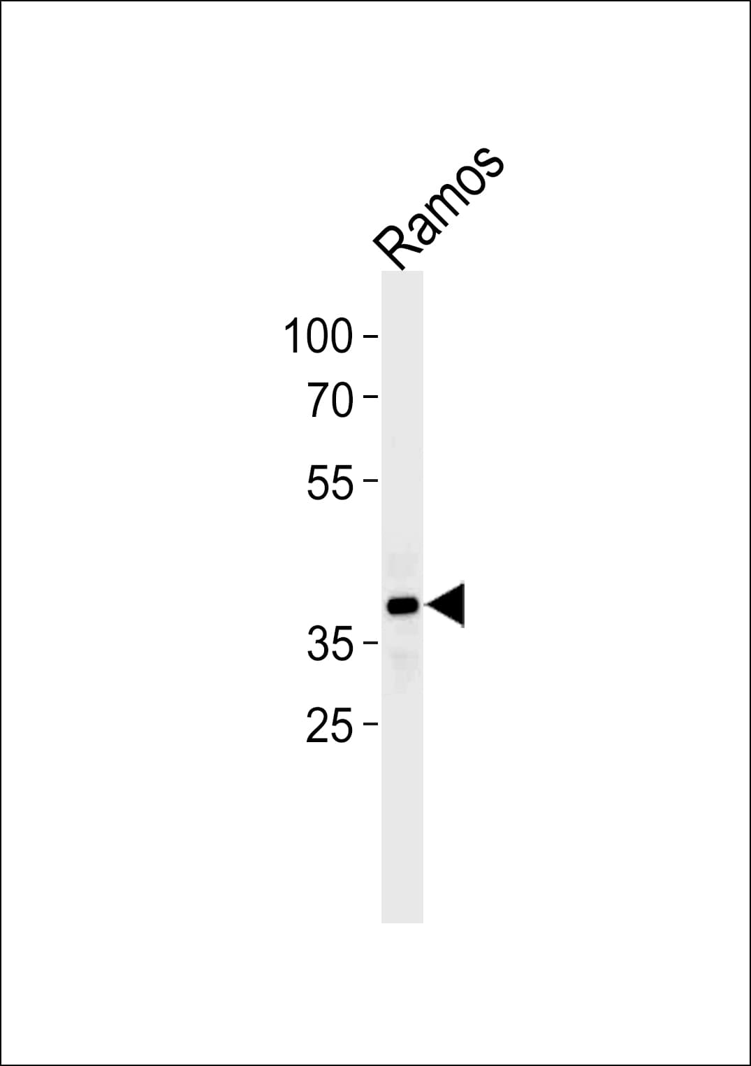 BCAP / PHF11 Antibody (aa158-191)