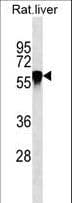 Antithrombin-III Antibody (aa50-79)