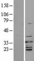 ARHGDIB / D4 GDI Protein (Over-Expression Lysate Myc-DDK (Flag))