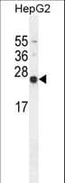 NUDT15 Antibody (aa89-118)