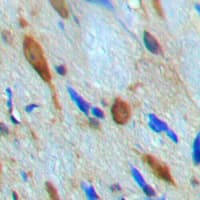 MKNK1 / MNK1 Antibody (Internal)