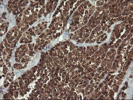 TRMT2A Antibody (clone OTI1C3)