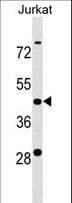 Polyclonal Rabbit anti-Human KCTD9 Antibody (aa179-207, WB)