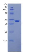 Rat MBL2 / Mannose Binding Protein (Recombinant His, N-Terminal)