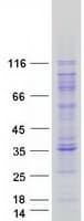 Human AARS Protein (Recombinant Myc-DDK (Flag))
