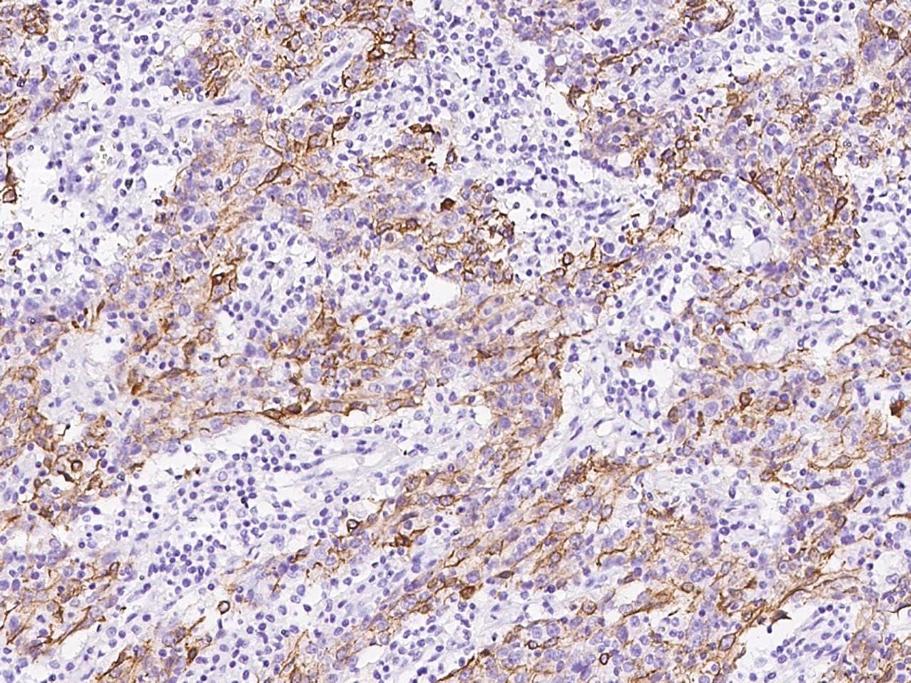 KRT6C / CK6C / Cytokeratin 6C Antibody