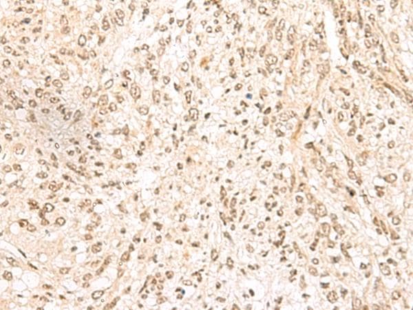 MDFI / I-MF Antibody