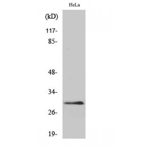 EIF3K Antibody (30-110 aa, Internal)