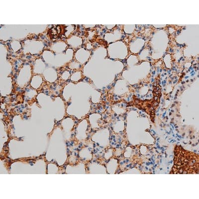 GATA1 Antibody (phospho-Ser142)