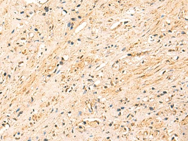 Polyclonal Rabbit anti-Human METTL10 Antibody (IHC)