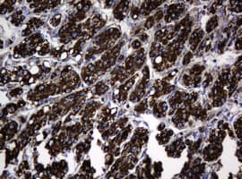 PathPlus™ HSPD1 / HSP60 Antibody (clone OTI3A2)