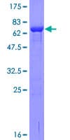 Human RABEPK / p40 Protein (Recombinant GST)