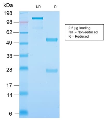 NEFH / NF-H Antibody (clone NEFL.H/2324R)