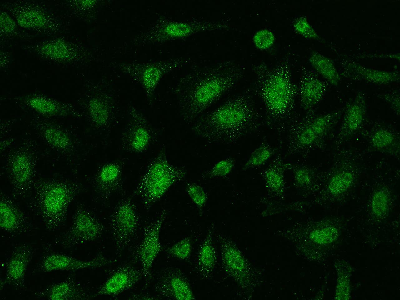 AMMECR1 Antibody