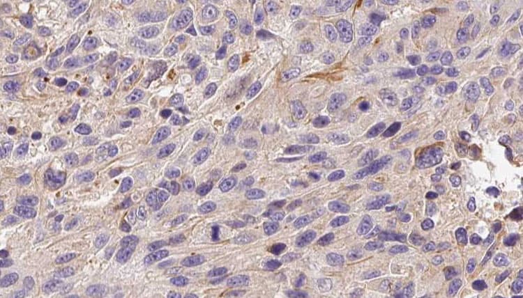 Polyclonal Rabbit anti-Human ADAMTS13 Antibody (IHC, WB)