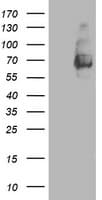 MAC-2-BP / LGALS3BP Antibody (clone OTI3G8)