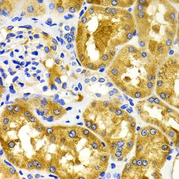 CDK20 / CCRK Antibody
