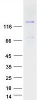 Human MAGI3 Protein (Recombinant Myc-DDK (Flag))