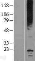 Human MIP Protein (Over-Expression Lysate Myc-DDK (Flag))