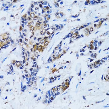 Polyclonal Rabbit anti-Human IMPA1 / IMP Antibody (IHC, IF, WB)
